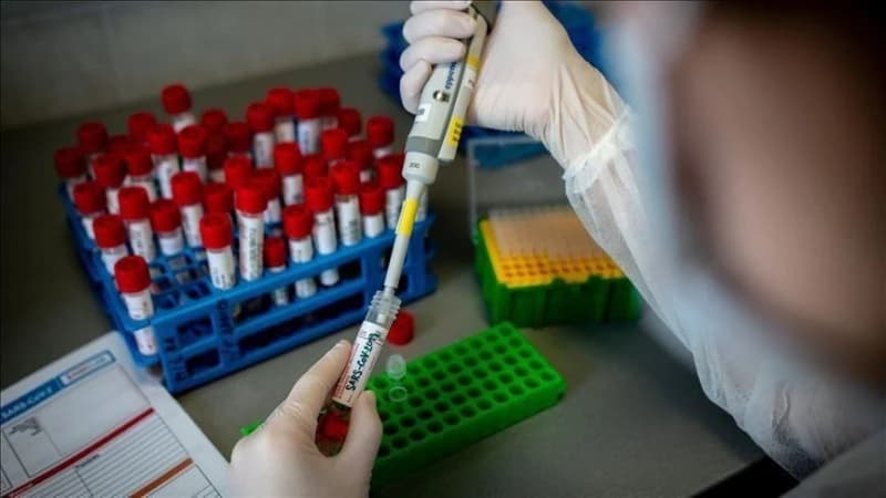 PCR laboratorija 