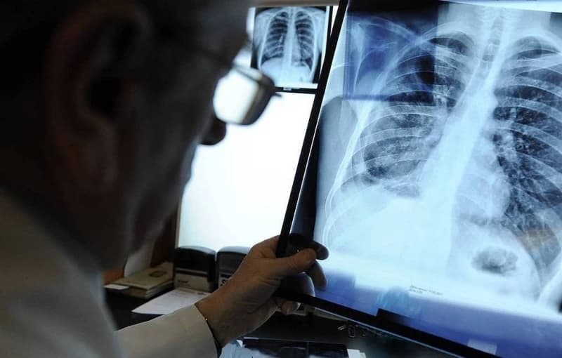 Osam hiljada ljudi širom svijeta se oporavilo od koronavirusa za tri dana