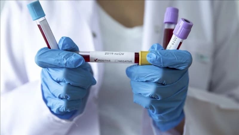Novih 11 osoba pozitivno na koronavirus u Hercegovini, u Konjicu troje oporavljenih