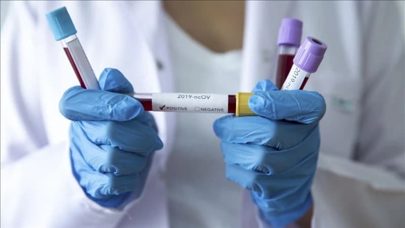 Raste broj oboljelih u BiH: Još 53 osobe testirane pozitivno na koronavirus