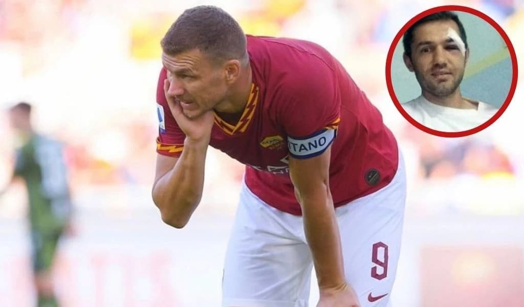 Povreda identična kao Džekina: Koliko je trajao oporavak Lulića nakon loma jagodične kosti?