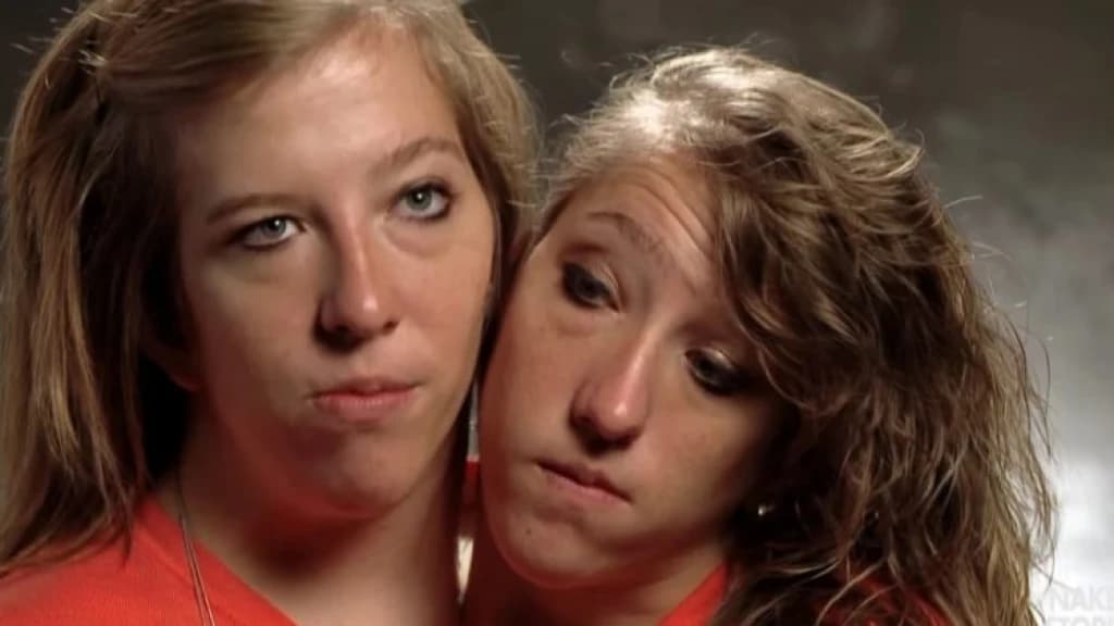 Abby i Brittany Hensel 