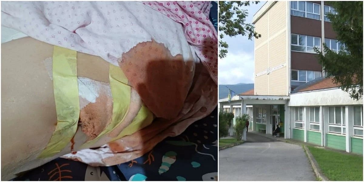Direktor Doma zdravlja Bosanski Petrovac optužuje medicinsku sestru da je krep-trakom zalijepila ranu pacijentici