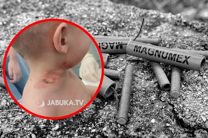Incident kod Širokog Brijega: Trogodišnjak povrijeđen usljed eksplozije petarde, zadobio opekotine