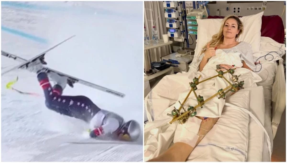 San o bajkovitom kraju pretvorio se u noćnu moru za Lindsey Vonn: Više od sedam dana nisam stala na noge...