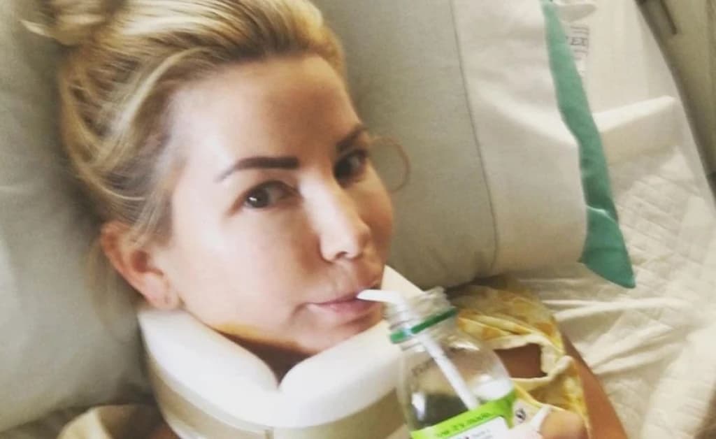  Žena koju je udario ruski bokser: Nos mi je eksplodirao, krv je bila svuda