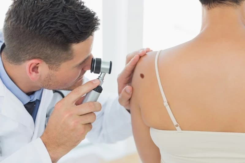 Besplatni pregledi na karcinom kože u 30 gradova BiH