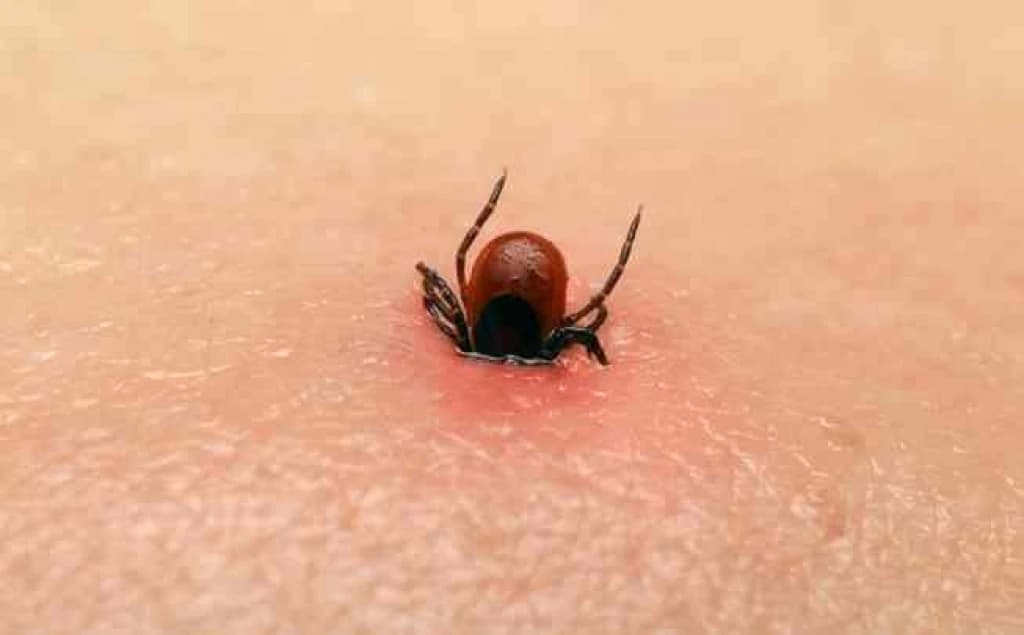 Mali ugriz, veliki problemi; krpelji mogu izazvati infekcije i Lajmsku bolest: Kada ih možete vaditi sami, a kada ne?