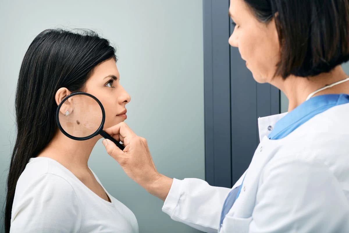 U BiH sve više osoba sa melanomom; dr. Alendar: Obolijevaju mladi između 20. i 40. godine života, a prednjače žene