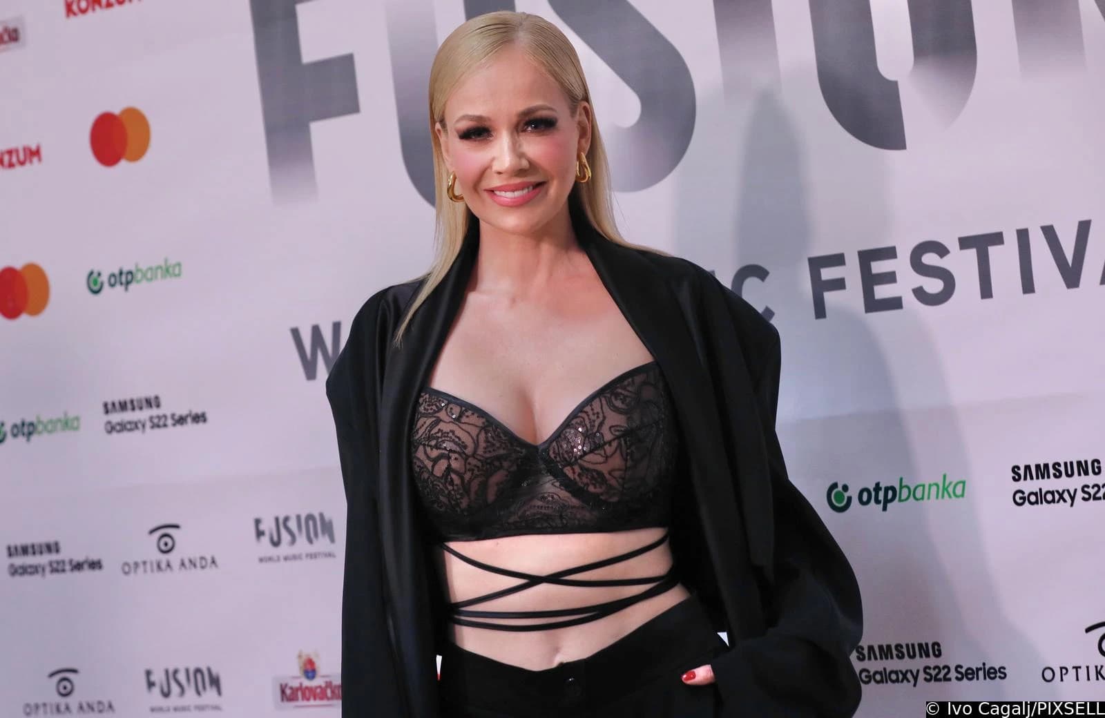 Jelena Rozga progovorila o estetskim zahvatima
