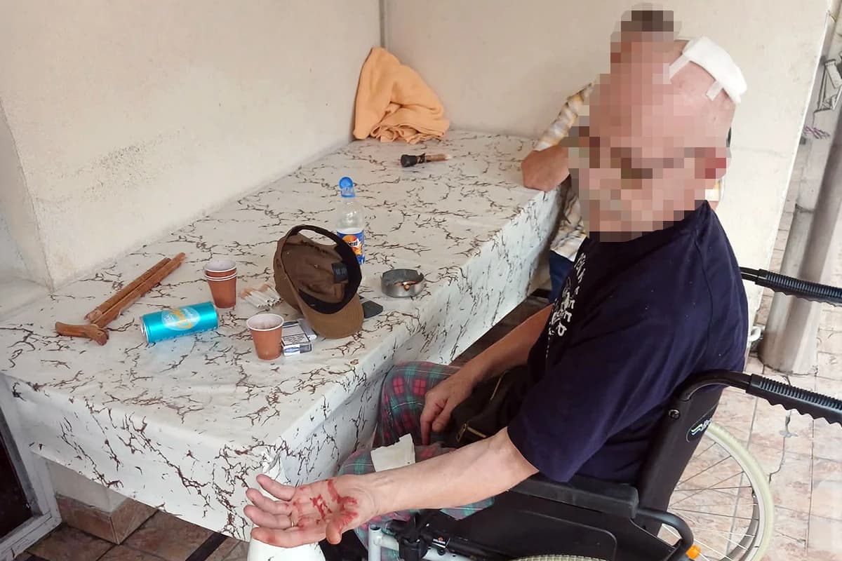 Drama u Gerontološkom centru u Sarajevu: Pijani korisnik štapom razbio glavu drugom, odvezla ga Hitna pomoć