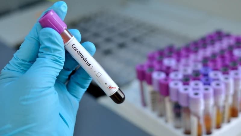 Testiranje na koronavirus besplatno, očekuje se isporuka 25.000 testova u RS-u