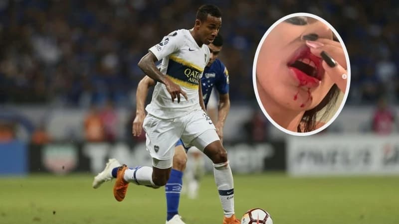 Fudbaler Boce Juniors brutalno pretukao djevojku, ona sve objavila na Instagramu