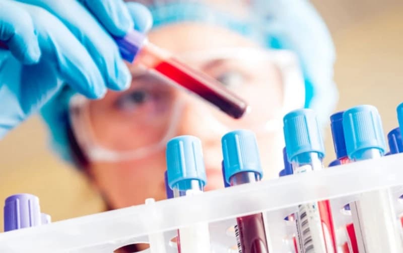Mikroplastika prvi put otkrivena u ljudskoj krvi