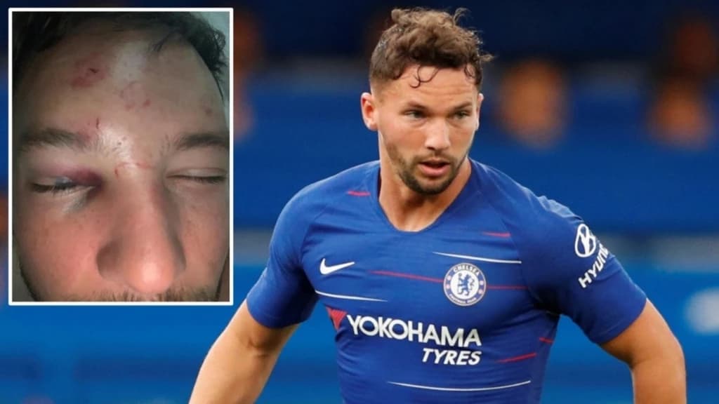 Drinkwater pauzira dvije sedmice nakon što je pretučen ispred noćnog kluba