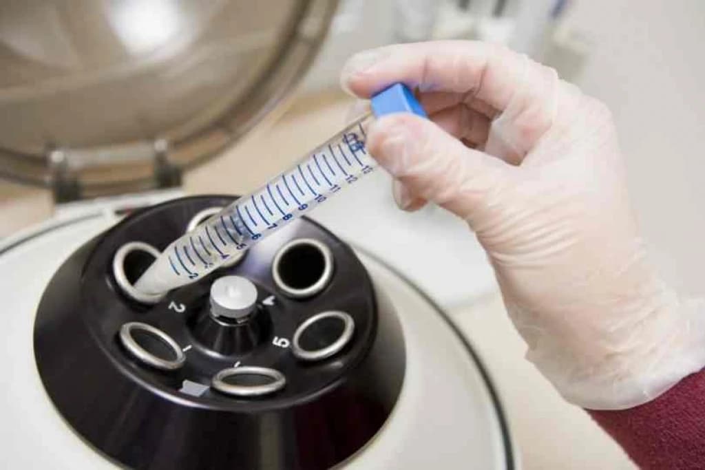 Biopsija, foto iluszracija