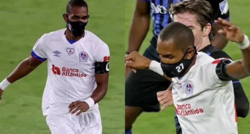 Dosad neviđeno: Napadač cijelu utakmicu igrao s maskom